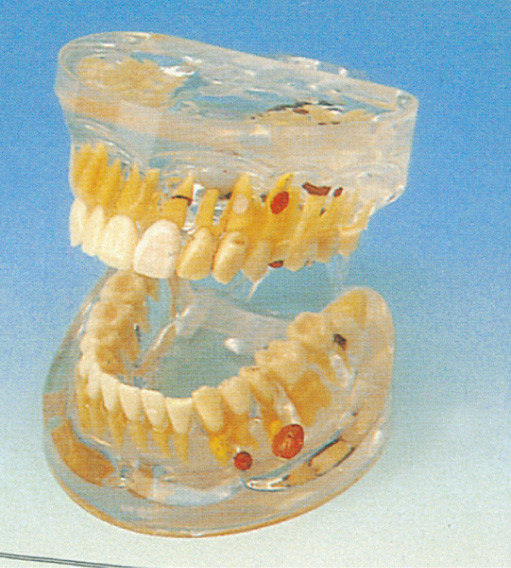 Modello umano dei denti di patologia dentaria trasparente adulta per la formazione degli istituti universitari