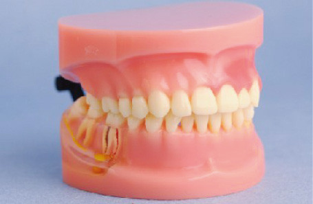 Modello del modello umano dei denti di malattia periodentale per gli istituti universitari medici e l'addestramento della clinica